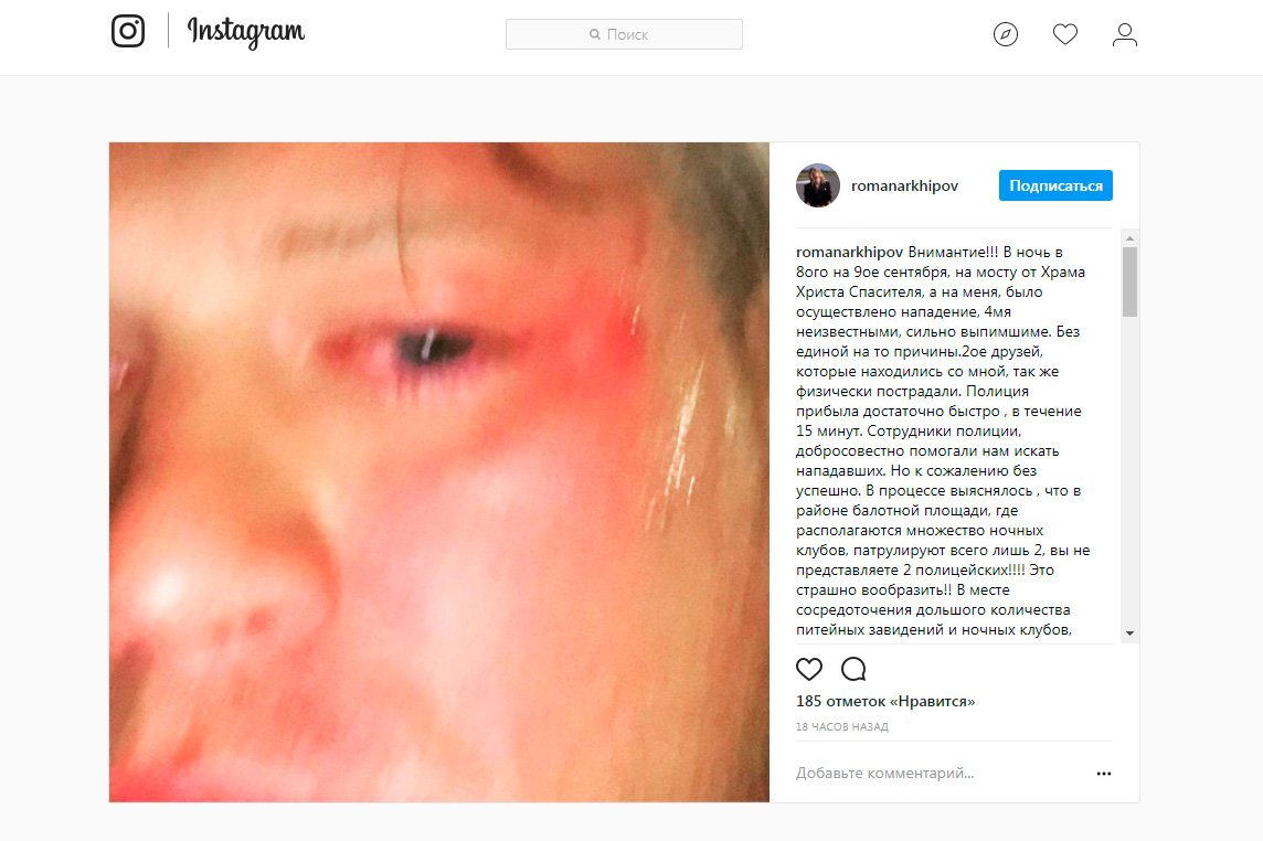 В центре Москвы избили певца Романа Архипова В центре Москвы избили певца Романа Архипова