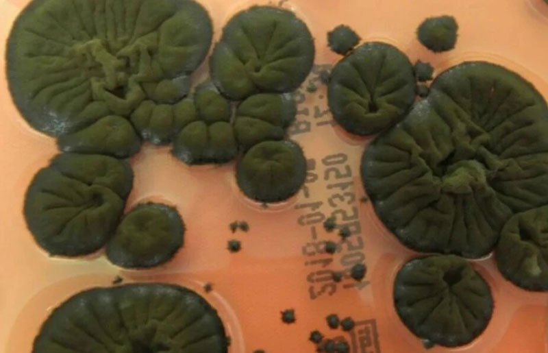 В Чернобыле нашли чёрный гриб, который растёт под воздействием радиации | Учёные изучают чернобыльский гриб, устойчивый к высоким уровням радиации