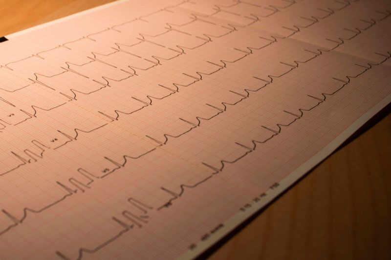 Врач назвала ранние признаки инфаркта | Врач Малиновская: боль в груди, одышка и потливость являются признаками инфаркта
