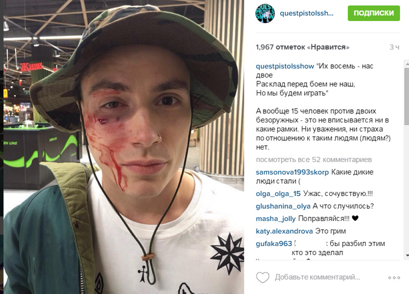 В центре Киева избили солиста Quest Pistols В центре Киева избили солиста Quest Pistols