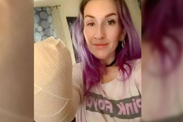 Женщине из Южной Каролины ампутировали руку из-за сильного ожога от фена | Девушка лишилась руки во время сушки волос феном Женщине из Южной Каролины ампутировали руку из-за сильного ожога от фена | Девушка лишилась руки во время сушки волос феном