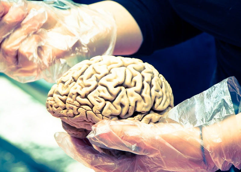 Ученые обнаружили у людей в мозгу крошечные частицы пластика | Исследование: человеческий мозг на 0,5 процента состоит из микропластика Ученые обнаружили у людей в мозгу крошечные частицы пластика | Исследование: человеческий мозг на 0,5 процента состоит из микропластика