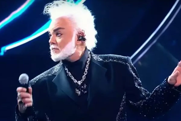 Липосакция, подтяжка лица и новые «кубики»: Киркоров рассказал, когда прекратит делать пластические операции Липосакция, подтяжка лица и новые «кубики»: Киркоров рассказал, когда прекратит делать пластические операции