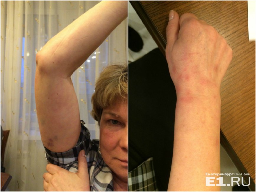 На Среднем Урале гаишники скрутили беззащитную женщину. Сын и мать готовят иск в суд на гаишников за превышение полномочий На Среднем Урале гаишники скрутили беззащитную женщину. Сын и мать готовят иск в суд на гаишников за превышение полномочий