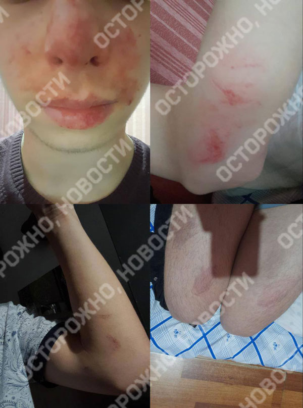 В Ингушетии пропал 16-летний подросток, которому родственники угрожали убийством чести | Подросток из Ингушетии исчез после жалобы на насилие и угрозы