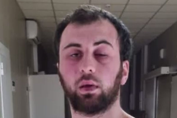 Житель Волгограда обвиняет полицейских в избиении, после которого попал в реанимацию Житель Волгограда обвиняет полицейских в избиении, после которого попал в реанимацию