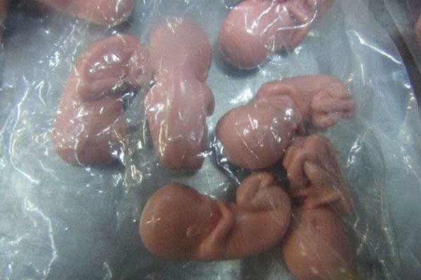 Женщину с 200 эмбрионами в чемодане задержали на российской таможне