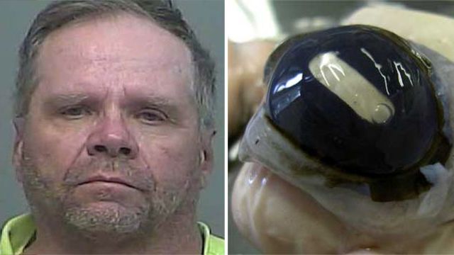 Шок! Полицейские обнаружили у мужчины 30 вырванных глазных яблок