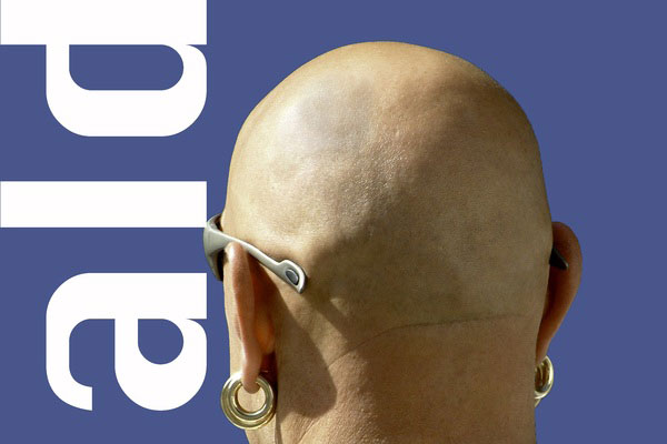 Учёные выявили взаимосвязь между облысением и кишечными бактериями Учёные выявили взаимосвязь между облысением и кишечными бактериями