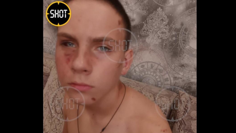 Полицейские из Волгограда жестоко избили 14-летнего подростка, приняв его за закладчика Полицейские из Волгограда жестоко избили 14-летнего подростка, приняв его за закладчика