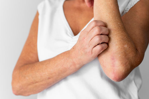 Зуд, кашель и покраснение глаз: 4 совета для тех, кто склонен к пищевой аллергии