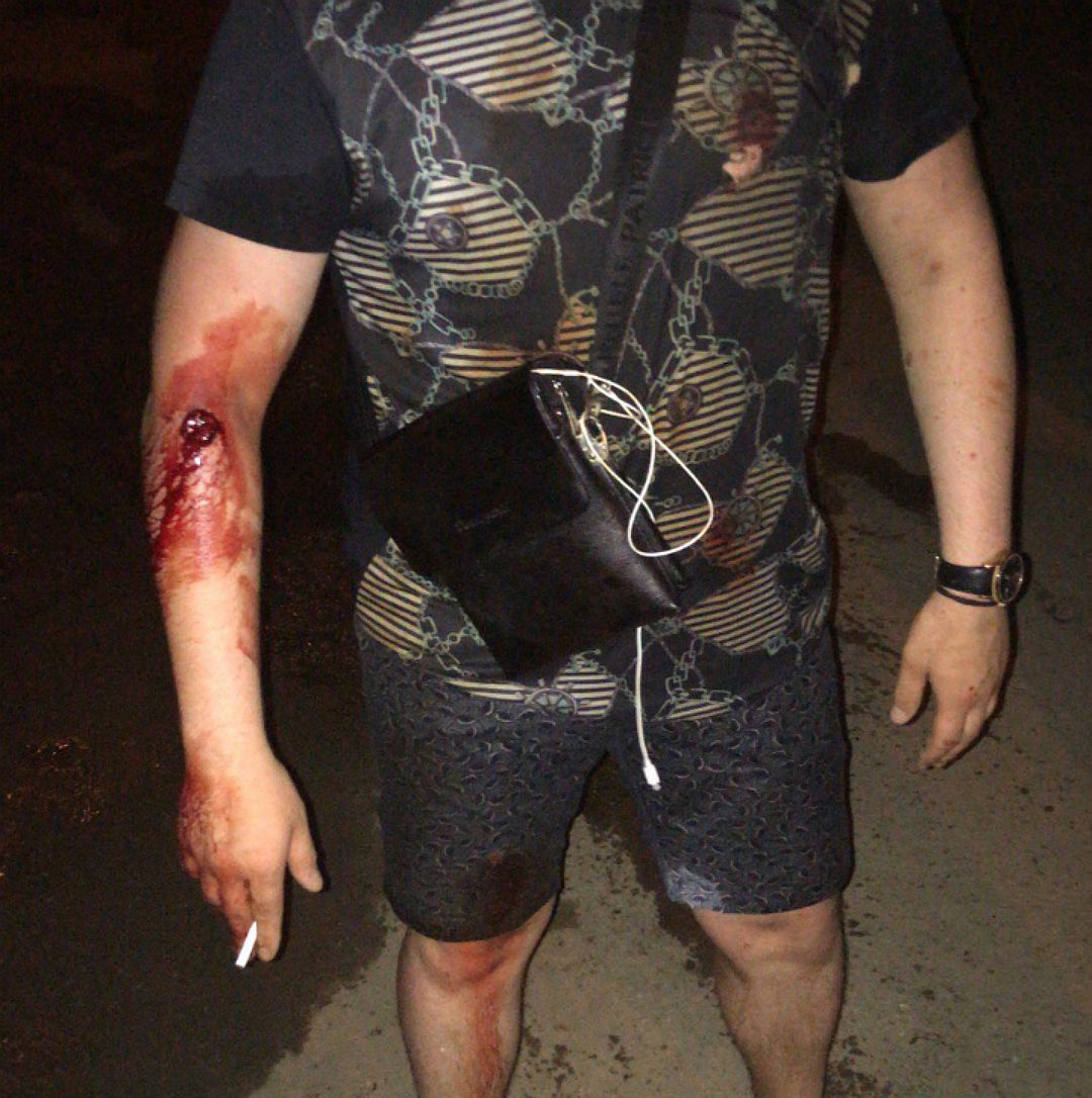 В Уфе произошла перестрелка: ранены двое В Уфе произошла перестрелка: ранены двое