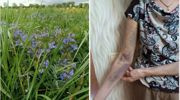 Учительницу литературы приняли за закладчицу и избили в Рязани | Учительницу литературы приняли за закладчицу и избили в Рязани