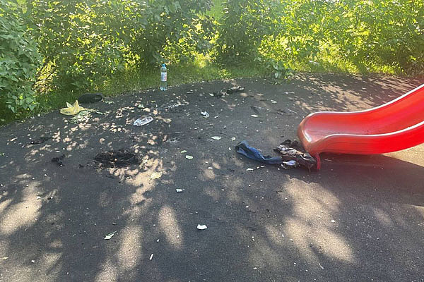 Подростку из Москвы, получившему во время игры с бензином ожоги почти всего тела, планируют вскрывать грудную клетку Подростку из Москвы, получившему во время игры с бензином ожоги почти всего тела, планируют вскрывать грудную клетку