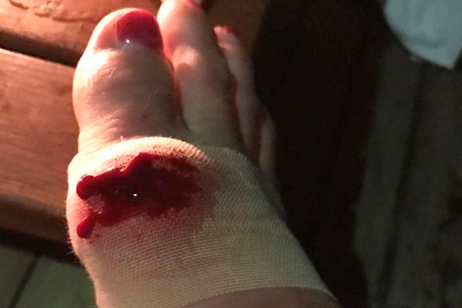 Врачи опасаются, что Волочкова лишится ног. Фото Врачи опасаются, что Волочкова лишится ног. Фото