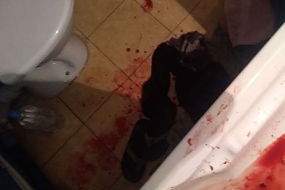 СК проводит проверку из-за смерти журналиста, которому медики останавливали кровотечение курицей СК проводит проверку из-за смерти журналиста, которому медики останавливали кровотечение курицей