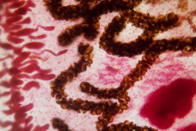 Доисторический паразит связан с повышение уровня моря и изменениями климата Доисторический паразит связан с повышение уровня моря и изменениями климата