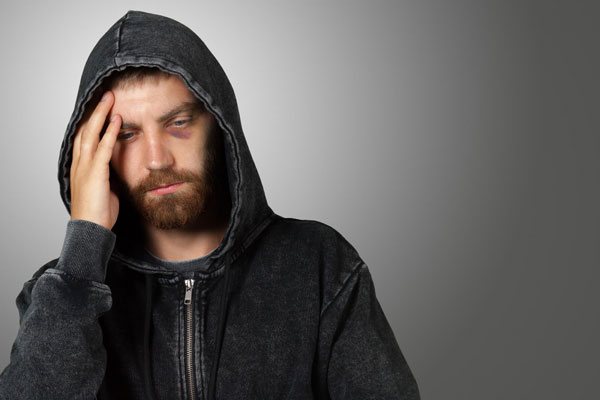 Йодные сетки не помогут: три способа уменьшить синяк Йодные сетки не помогут: три способа уменьшить синяк