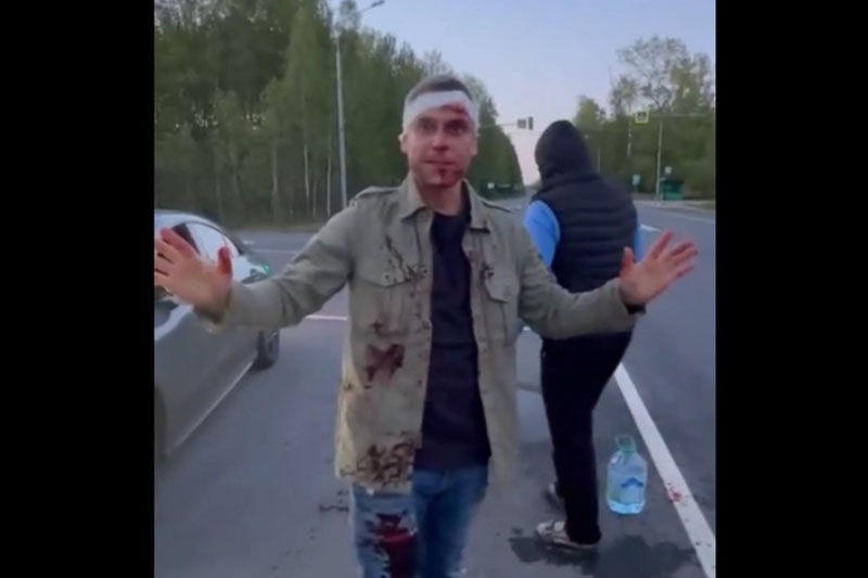 На Дмитровском шоссе в Подмосковье водитель такси сбил лося и получил травмы | «Лбом встретил»: в Подмосковье таксист сбил лося